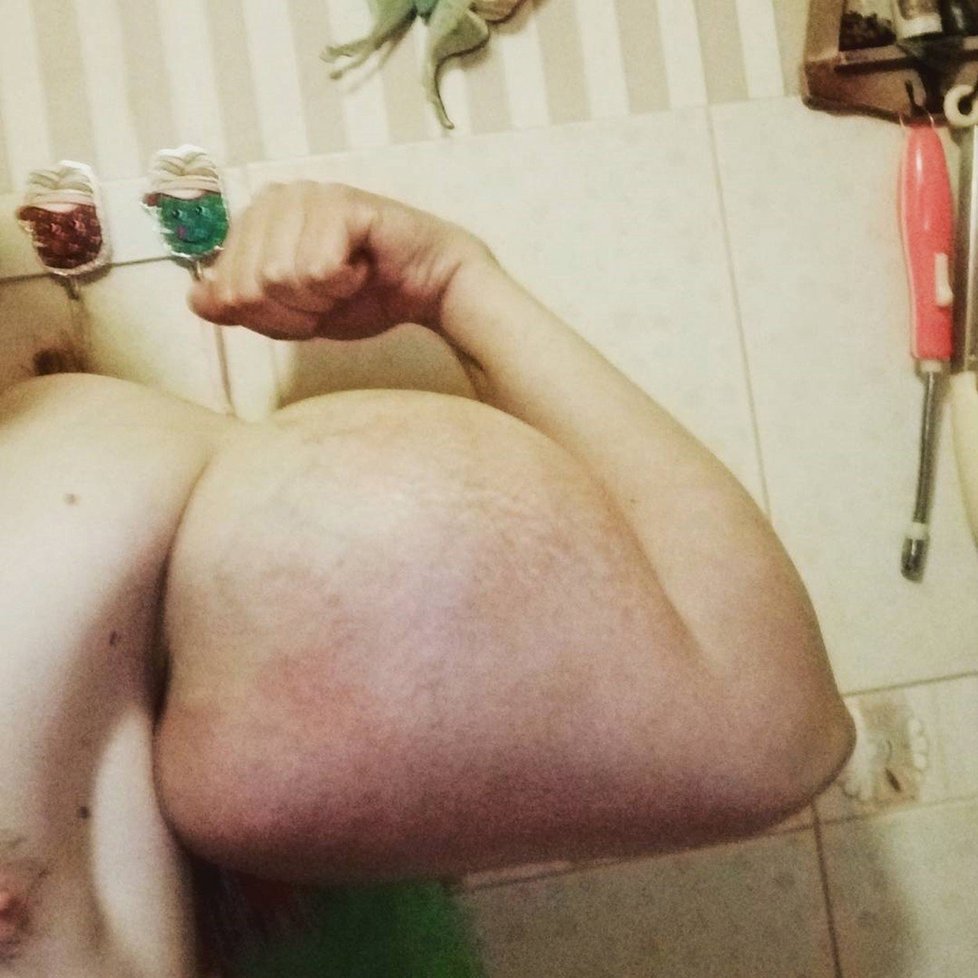 Kiril Těrešin (21) z Ruska si do svalů píchá nebezpečný olej, aby zlomil rekord v kulturistice.