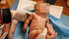 Překotný porod v Kladně: Miminko přišlo na svět během tří minut!