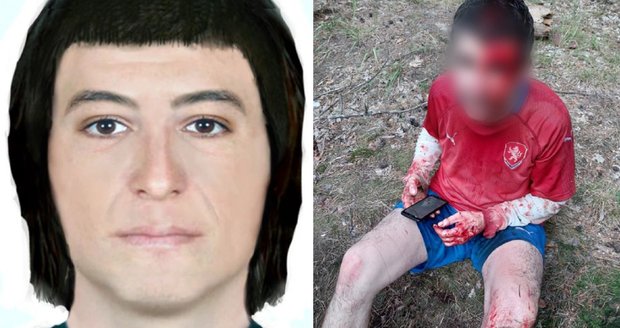 Běžce v Klánovickém lese napadl neznámý muž: Klackem ho zbil do krve! poznáte ho?