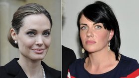 Paní Klára chce podstoupit mastektomii stejně jako Angelina Jolie