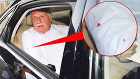 Prezident Václav Klaus po atentátu krvácel na pěti místech pravé paže. Musel na krátké ošetření do nemocnice.