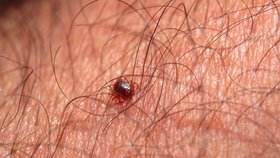 Klíště je kvůli nemocem, které přenáší, velkou hrozbou pro člověka (ilustrační foto).