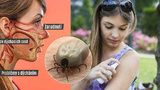 Vosy, včely, sršni, komáři a klíšťata: Znepříjemňují nám v létě život