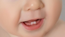 Nepřehánějte to s fluorem u dětí, způsobuje fleky na zubech