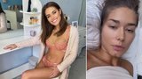Krásná miss Kokešová (24) opět na plastice: Třetí řezání prsou za rok!