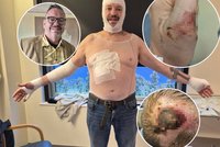 Táta Michael přežil pád do kolejiště: Těžké popáleniny a zástava srdce