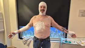 Veterán Michael přežil pád do kolejí.