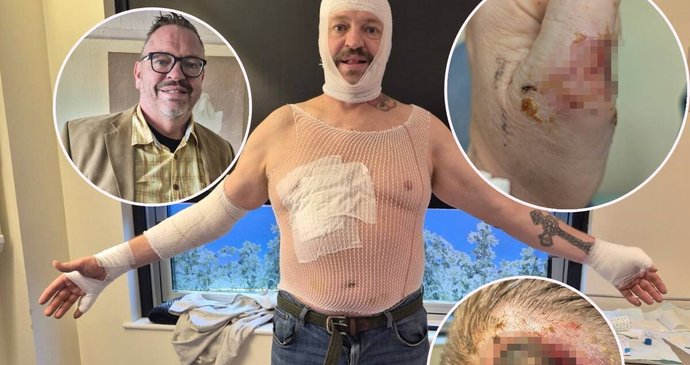 Veterán Michael přežil pád do kolejí.