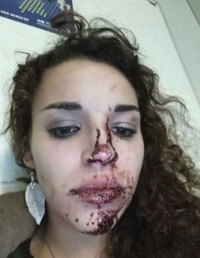 Dívce ze Stuttgatu útočníci na hlavu hodili skleněnou láhev a pak ji zbili.