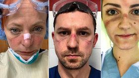 Hrdinové bitvy s koronavirem: Fotky zdravotníků po celodenním boji v nemocnicích