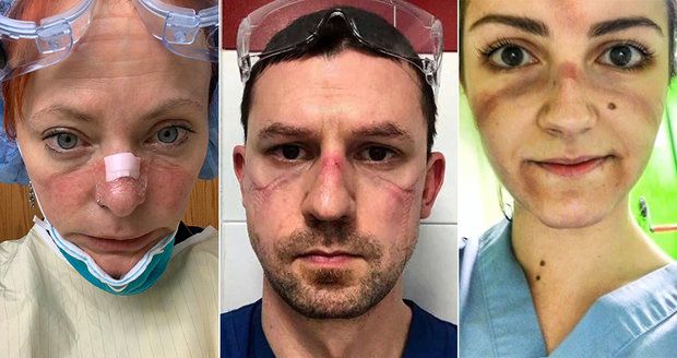 Hrdinové bitvy s koronavirem: Fotky zdravotníků po celodenním boji v nemocnicích šokují