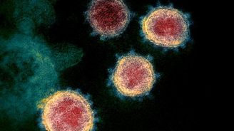 Mikrobiolog: Začátek epidemií bývá prudší, ale časem se virus „zklidní“, aby nezničil svého hostitele