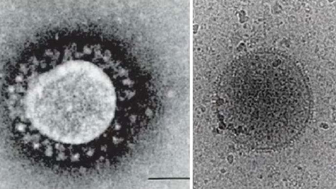 Koronavirus SARS-CoV-2 vs. buněčný exozom