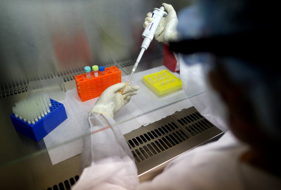 Příprava analýzy koronaviru v laboratoři Mlabran v Buenos Aires