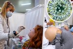 Izrael hlásí první případ „flurony“. Těhotná pacientka je pozitivní na koronavirus i chřipku