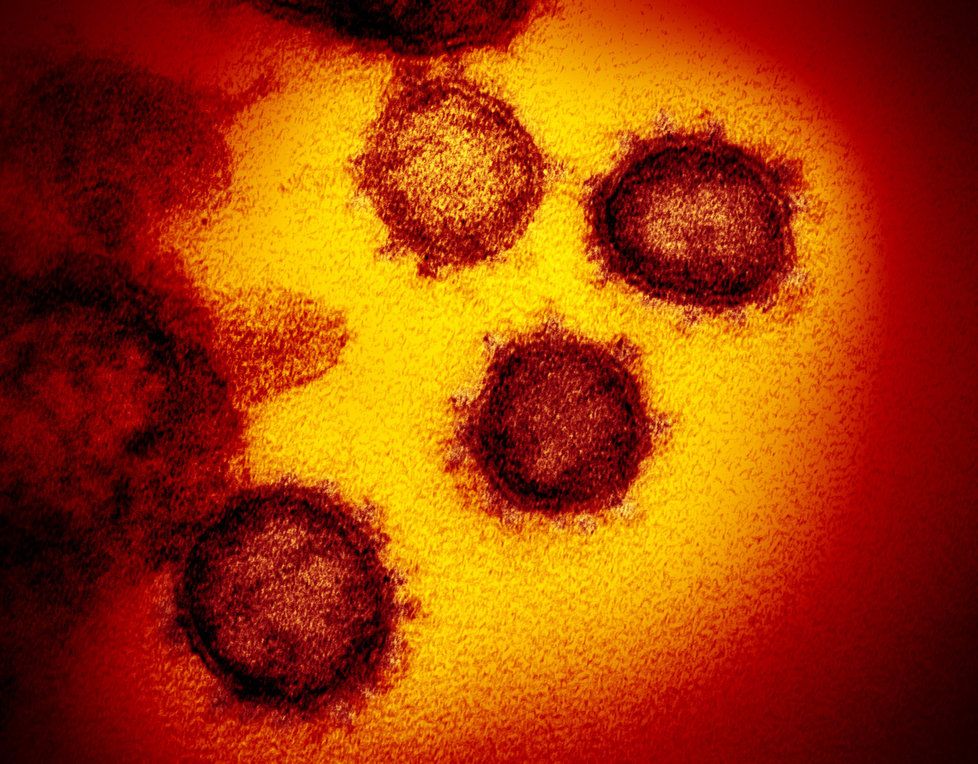 Koronavirus pod mikroskopem v USA