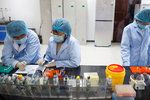 Koronavirus v Číně: Výzkum v pekingské laboratoři.