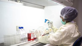 Vědci z celého světa pracují na vývoji vakcíny, snímek z thajské laboratoře.