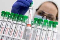 Experti zkoumají další subvarianty omikronu: Zřejmě jsou nakažlivější