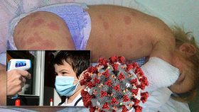 Záhadná nemoc ohrožuje děti, může souviset s koronavirem (ilustrační foto)