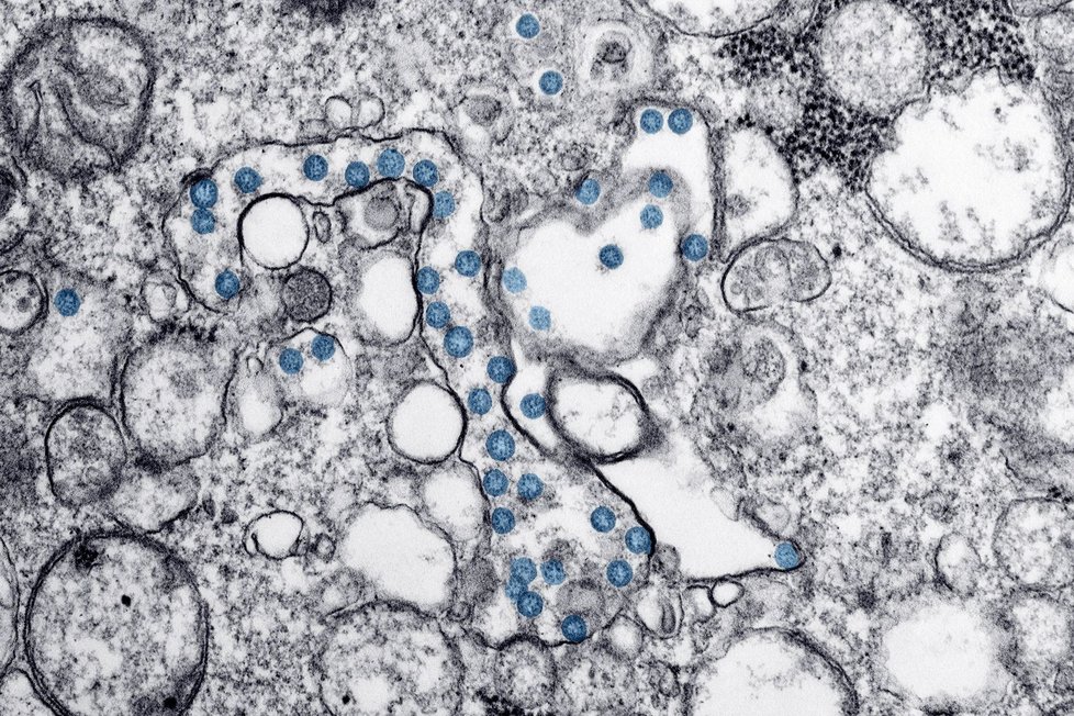 Snímek koronaviru