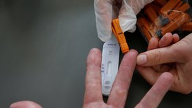 Koronavirus ve Francii: Testování protilátek