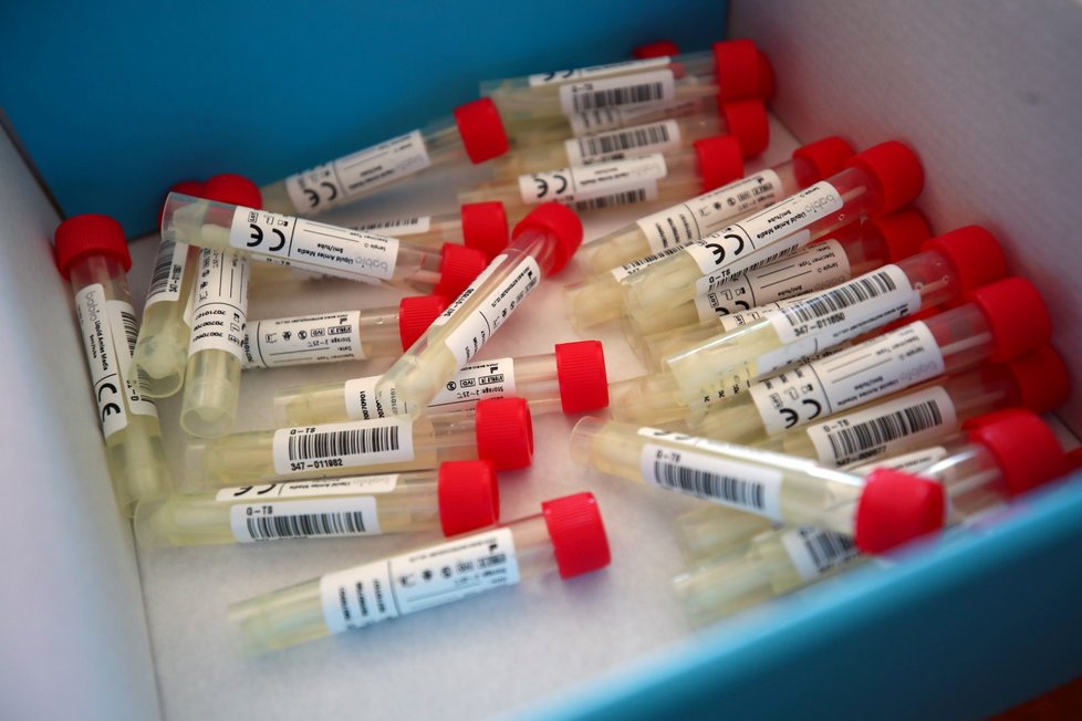 Testování na koronavirus v Německu