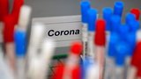 V USA uvádějí na trh nový test na koronavirus. Výsledky mají být do několika minut