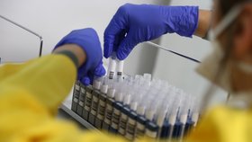 Testování na koronavirus v Německu
