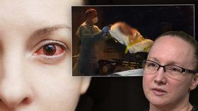 Sestra popsala nový symptom COVID-19: zarudnutí očí. Všichni její pacienti tento příznak měli.
