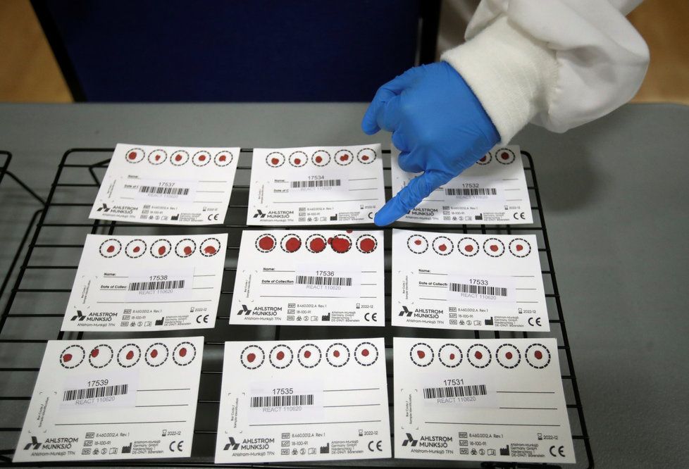 Test na protilátky proti koronaviru