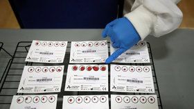 Test na protilátky proti koronaviru