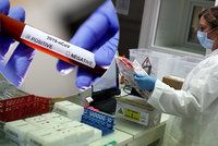 Čínské rychlotesty jsou k ničemu, tvrdí lékařka. Chybovost 80 procent exministr odmítl