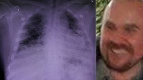 Oblíbený lékař Rastislav (48) zemřel po boji s covid-19: Virus mu zcela zničil plíce