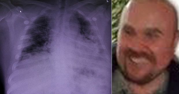 Oblíbený lékař Rastislav (48) zemřel po boji s covid-19: Virus mu zcela zničil plíce