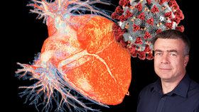 Koronavirus poškozuje srdce, varuje kardiolog.