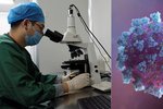 Podle nové studie by koronavirus mohl mít vliv na mužskou plodnost