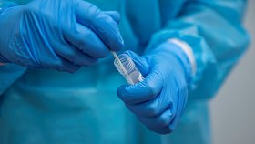 Testování na koronavirus v Česku