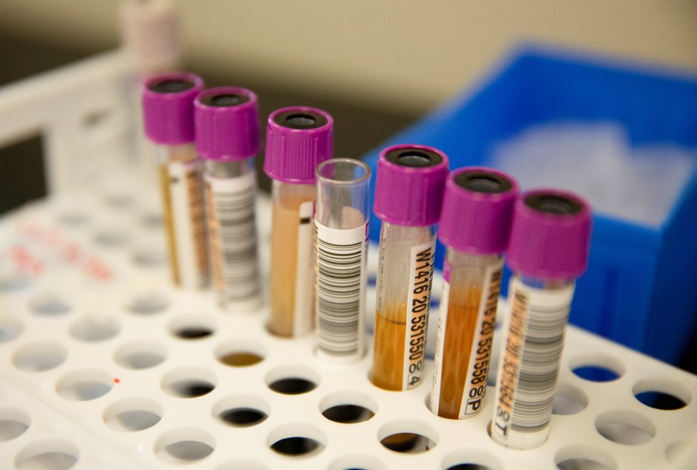 V USA testují plazmy lidí vyléčených z covid-19 jako možný lék proti koronaviru