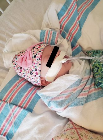 Dvouměsíční Ellie má koronavirus, její matka sdílela fotky miminka připojeného na ventilátor.