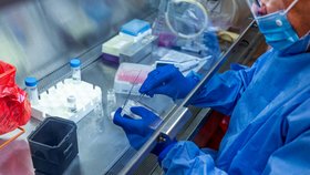 Pittsburská univerzita se snaží vynalézt vakcínu proti koronaviru. (2.4.2020)