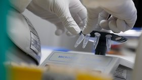 Rusko prý již vyrábí vakcínu proti koronaviru