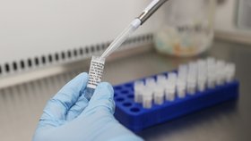 Vakcínu proti koronaviru se snaží vyvinout řada laboratoří.