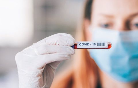 Jak probíhá testování na koronavirus? Poradíme vám, zda se objednat předem a kdy se dozvíte výsledky