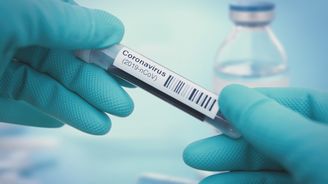 Lék na koronavirus: Vědci již leccos objevili, vše se ale musí testovat. Jak daleko jsme od léku či vakcíny?