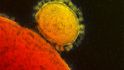 Kromě nemoci COVID-19 způsobují koronaviry také další nebezpečná onemocnění SARS a MERS. NA obrázku je virus MERS přichycený k buňce