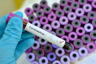 Koronavirus řádí už i v Itálii. Jak moc je situace vážná?