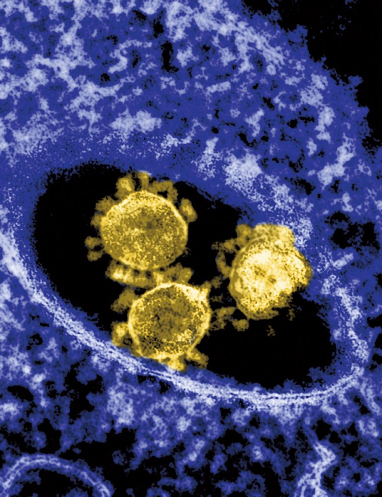 Koronaviry dostaly jméno podle svých povrchových struktur, které připomínají sluneční koronu