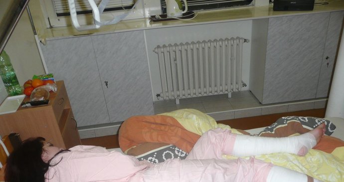 Studentka Zuzana si v košické MHD zažila hororovou situaci: Neznámý pachatel ji polil kyselinou