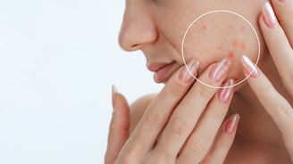 Aktivní látky v kosmetice: co vaší pleti opravdu dělají? Aktivní látky v kosmetice: co vaší pleti opravdu dělají?
